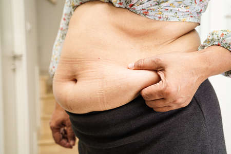 Overweight asian woman use hand to squeeze fat belly big size overweight and obesity.の写真素材