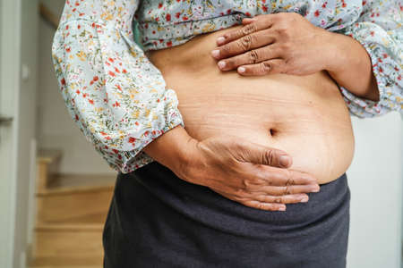 Asian woman show fat belly big size overweight and obesity at office.の写真素材