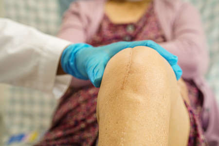 Asian elderly woman patient with scar knee replacement surgery in hospital.
