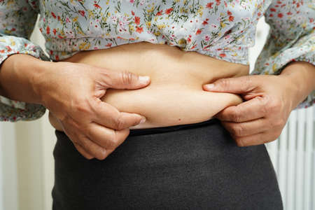 Overweight asian woman use hand to squeeze fat belly big size overweight and obesity.の写真素材
