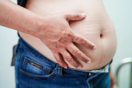 Asian woman show fat belly big size overweight and obesity at office.の写真素材