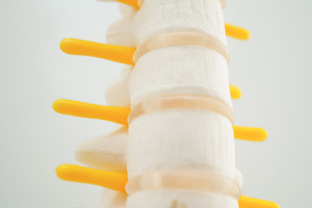Spinal nerve and bone, Lumbar spine displaced herniated disc fragment, Model for treatment medical in the orthopedic department.の写真素材