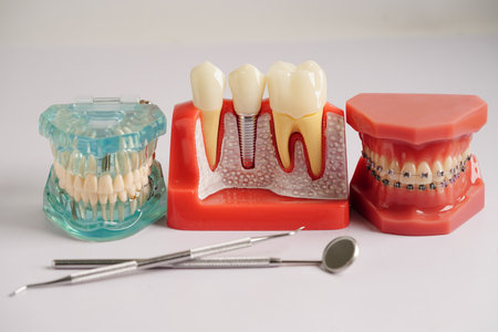 Dentist equipment, dental instrument, tools for dental professionals use to provide dental...