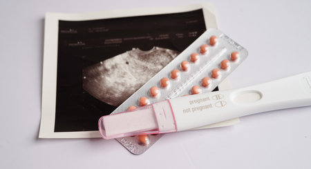 Pregnancy test with ultrasound scan photo of fetus, maternity, childbirth, birth control.の写真素材