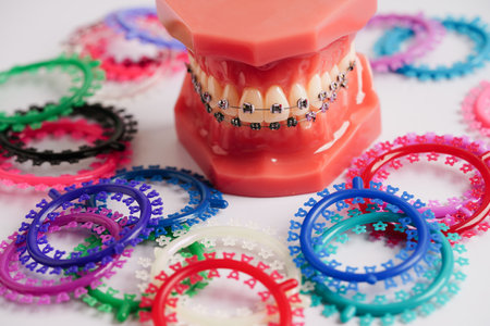 Orthodontic ligatures rings and ties, elastic rubber bands on orthodontic braces, model for dentist studying about dentistry.の写真素材
