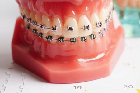Dental appointment reminder in calendar, healthy teeth, dental health care.の写真素材