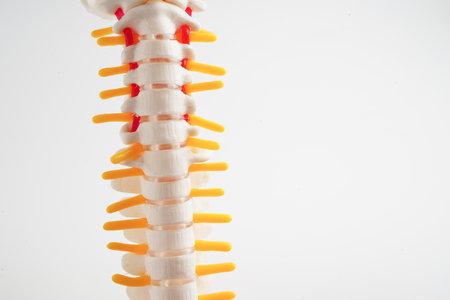 Spinal nerve and bone, Lumbar spine displaced herniated disc fragment, Model for treatment medical in the orthopedic department.の写真素材