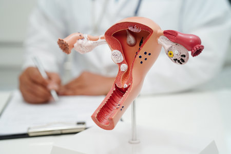 Uterus, doctor holding human anatomy model for study diagnosis and treatment in hospital.