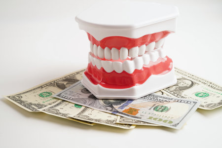 Treatment dental care cost, dental expense or fee, US dollar banknote money with teeth model.の写真素材