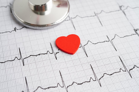Stethoscope on electrocardiogram (ECG), heart wave, heart attack, cardiogram report.