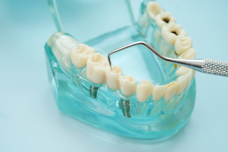 Teeth dental model with tool for dentist use to cleaning care treatment.