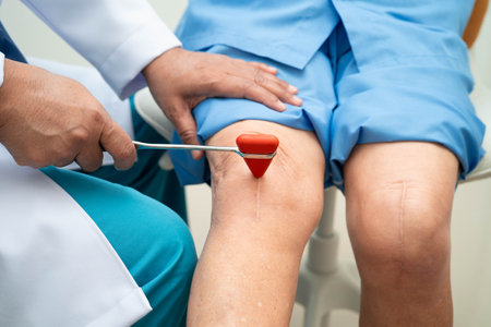 Asian doctor knock on knee reflex nerve for check and treatment senior patient in hospital.の写真素材