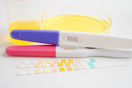 Urinalysis, urine cup with reagent strip pH paper test and comparison chart in laboratory.の写真素材