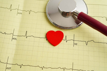 Stethoscope on electrocardiogram (ECG), heart wave, heart attack, cardiogram report.の写真素材