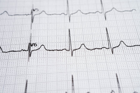 Electrocardiogram (ECG), heart wave, heart attack, cardiogram report.の写真素材