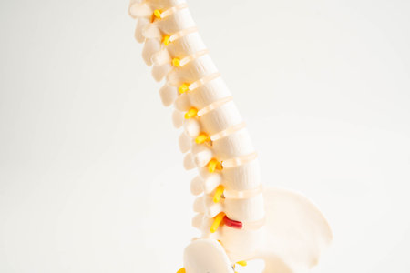 Spinal nerve and bone, Lumbar spine displaced herniated disc fragment, Model for treatment medical in the orthopedic department.の写真素材