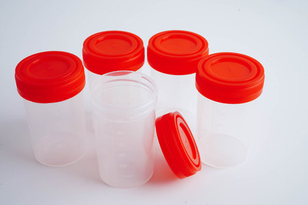 Urinalysis, urine cup for check health examination in laboratory.