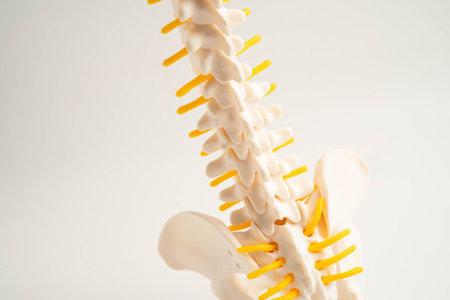 Spinal nerve and bone, Lumbar spine displaced herniated disc fragment, Model for treatment medical...