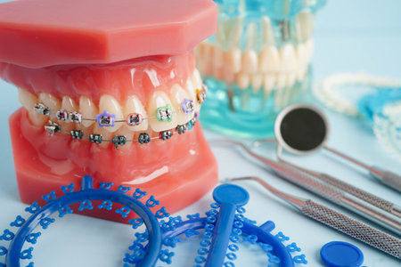 Orthodontic ligatures rings and ties, elastic rubber bands on orthodontic braces, model for dentist...