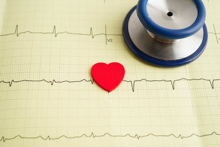 Stethoscope on electrocardiogram (ECG), heart wave, heart attack, cardiogram report.の写真素材