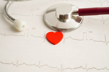 Stethoscope on electrocardiogram (ECG), heart wave, heart attack, cardiogram report.の写真素材
