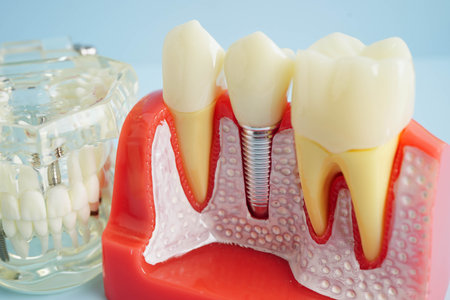 Dental teeth model on white background for learn about dentistry.