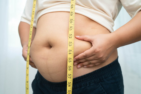 Asian woman with fat belly big size overweight and obesity with measure tape.