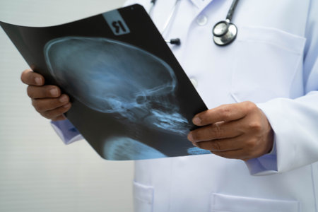 Doctor examining brain radiography xray film.