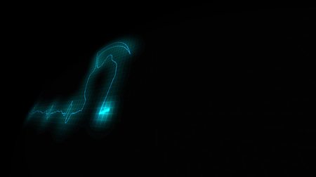 Cardiogram of death. Heart Attask. Cardiogram of a diseased heartの写真素材