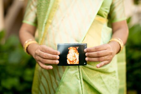 a lady holding a scan photo of her babyの写真素材