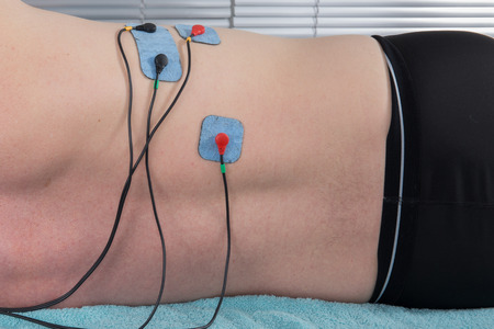 Orthopaedic treatment electrostimulator. Electrodes of the girl in neck.の写真素材