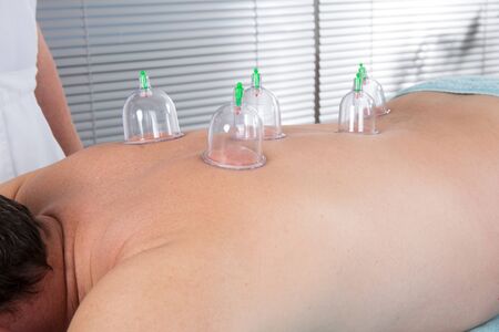 Alternative massage , a male having a chinese therapy to cureの写真素材