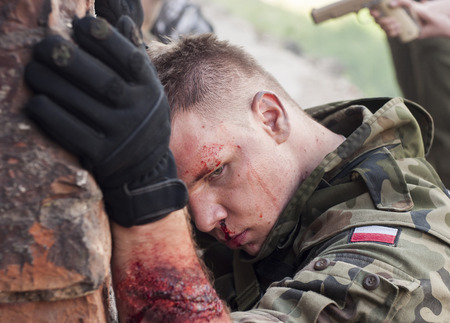 SZCZECIN, POLAND - MAY 31, 2014: Wounded Soldier in Polish Army uniform during  Historical reenactmentのeditorial素材
