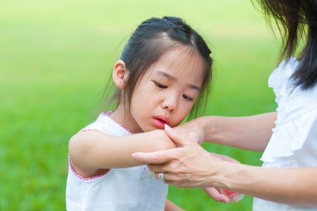 Mother checking wound to her daughter at outdoor parkの写真素材