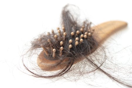 Hairloss problem. Brush with lost hair on it, isolated on white background.の写真素材