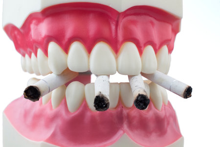 Dental mold biting and cigarettes