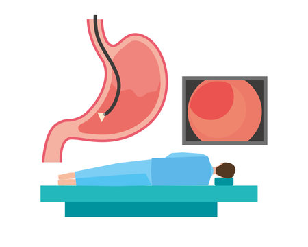 Image illustration of examination with gastroscopeのイラスト素材
