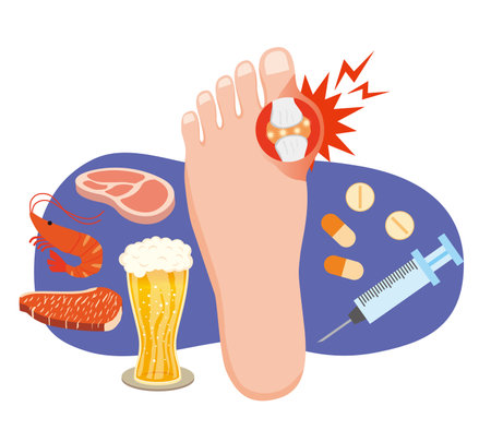 Illustration of a gout attackのイラスト素材