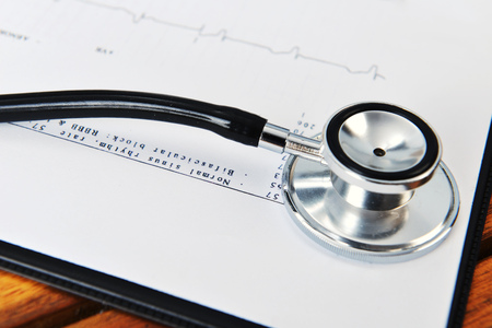 stethoscope on printout of heart monitor -blue tint on wooden backgroundの写真素材