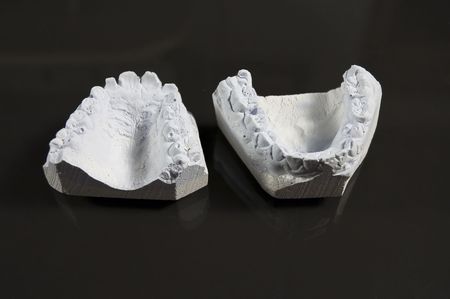 Gypsum's invert model of tooth for artificial toothの写真素材
