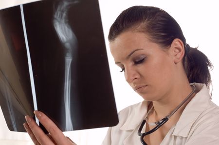 Female doctor holding x ray film at laboratory