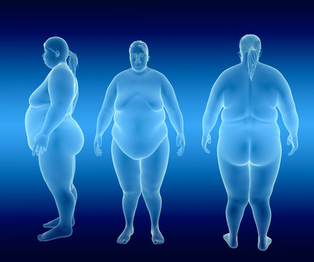 Render Illustration of Obese Womanの写真素材