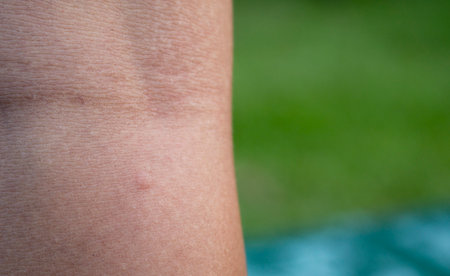 swollen skin from mosquito bites.の写真素材