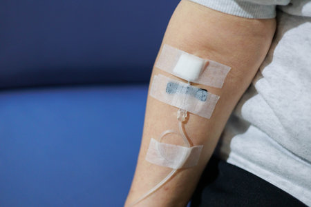 Arm of a woman with a drip