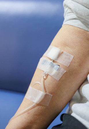 Arm of a woman with a dripの写真素材
