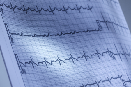 Close up of electrocardiogram
