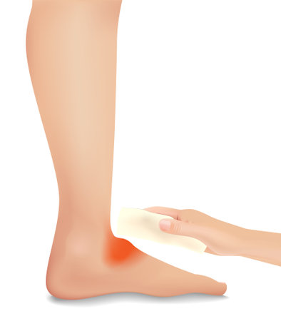 Paste a medical gel sheet To treat the scar in the foot.のイラスト素材
