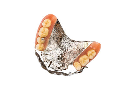 Top view of partial metal removable swinglock denture on white background