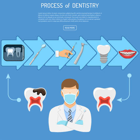Process of Dentistry Concept with flat icons dentist, braces, dental drill, x-ray, syringe and implant.のイラスト素材