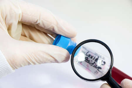 Corona virus positive blood test tubes on the white background, studio shoot. Blood test samples. Diagnosis and laboratory.の写真素材